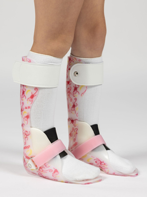 Custom Ankle Foot Orthosis (AFO) brace in Newmarket fitted by certified pedorthists at MyoDynamic Health for foot drop, neurological conditions and ankle stability